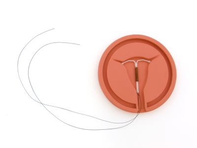 El riesgo de cáncer cervical es menor en mujeres que usan dispositivos intrauterinos