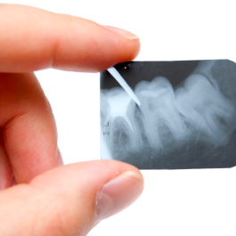 Las radiografías dentales ¿aumentan el riesgo de desarrollar tumores cerebrales?