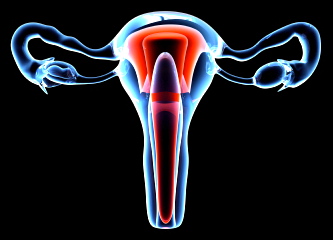 Nuevo medicamento contra los fibromas uterinos