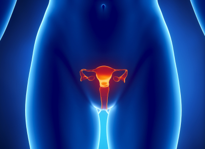 ¿Sabías que la endometriosis aumenta el riesgo de tres tipos de cáncer del ovario?
