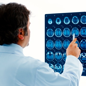 Más tomografías cerebrales en niños podrían significar más riesgo de cáncer en adultos