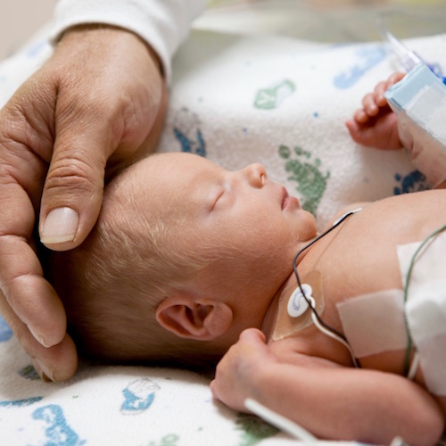 Los cuidados que necesita un bebé prematuro